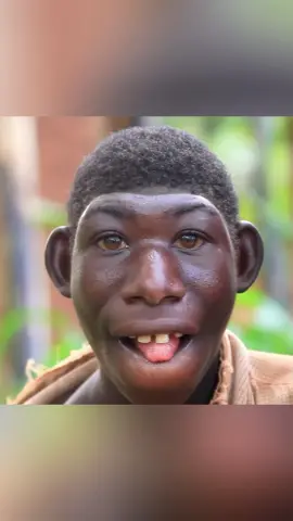 Do you know Monkey Boy?#amazing #DidYouKnow #knowledge #fyp 