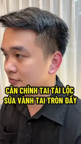 Cân chỉnh vành tai tròn đầy , tạo dáng tai tài lộc #nganle #fillerhn #ilovetiktok #xuhuong #fillersg 