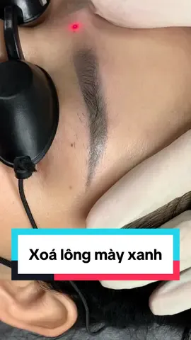 Thay đổi để trở nên tốt hơn,lông mày cũng vậy xoá làm lại để đẹp hơn.