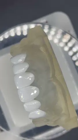 Kết hợp kim cương 💎 & Tráng Gương#diamond