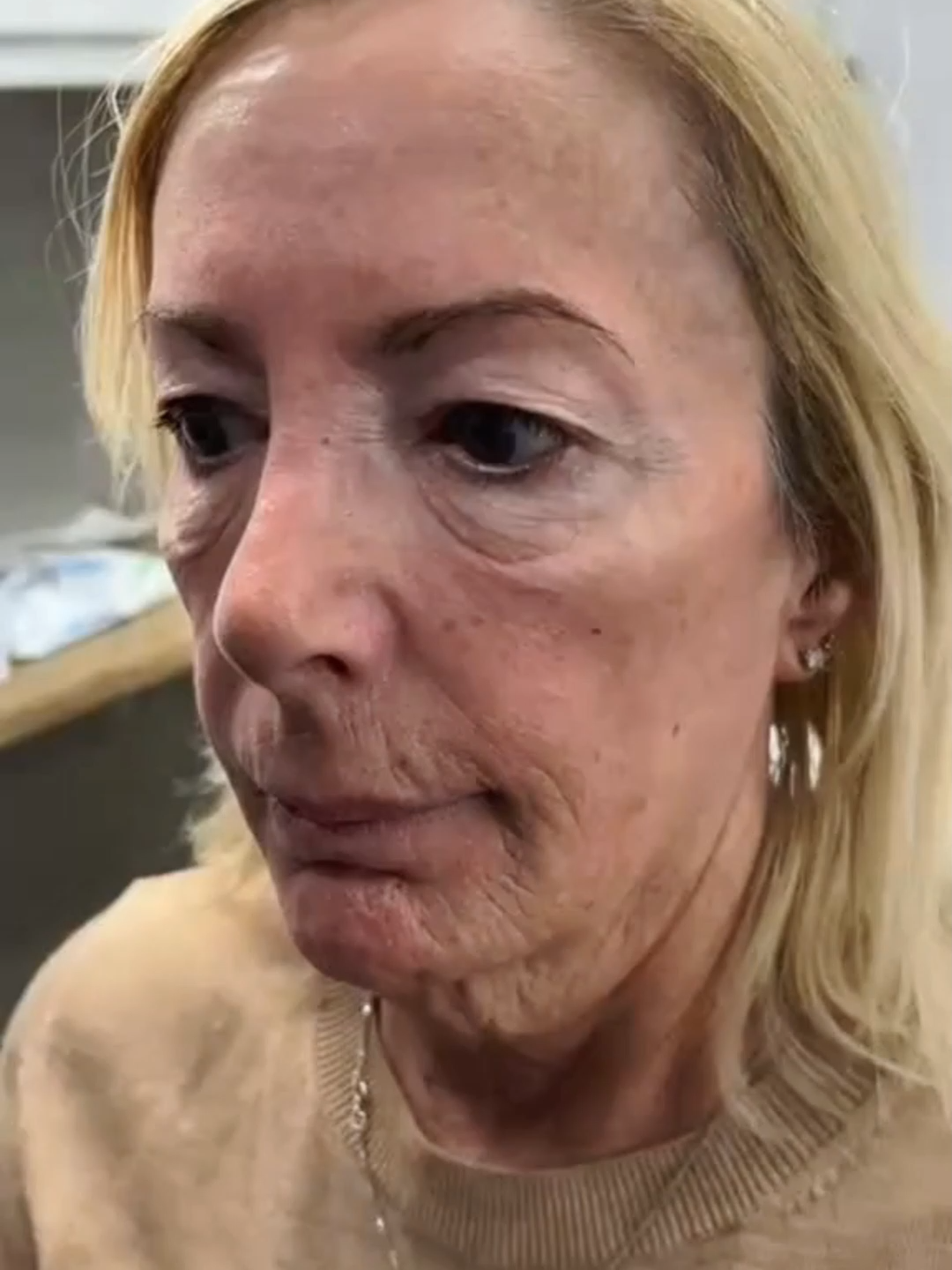 The Vita A Retinal Shot Tightening Booster | with Retinal#Retinal #firmerskin #retinolskincare #fpy