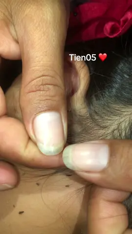 Remove lice #olebrandselect #lice #omg ❤️❤️❤️#liceromoval #🥰🥰🥰 