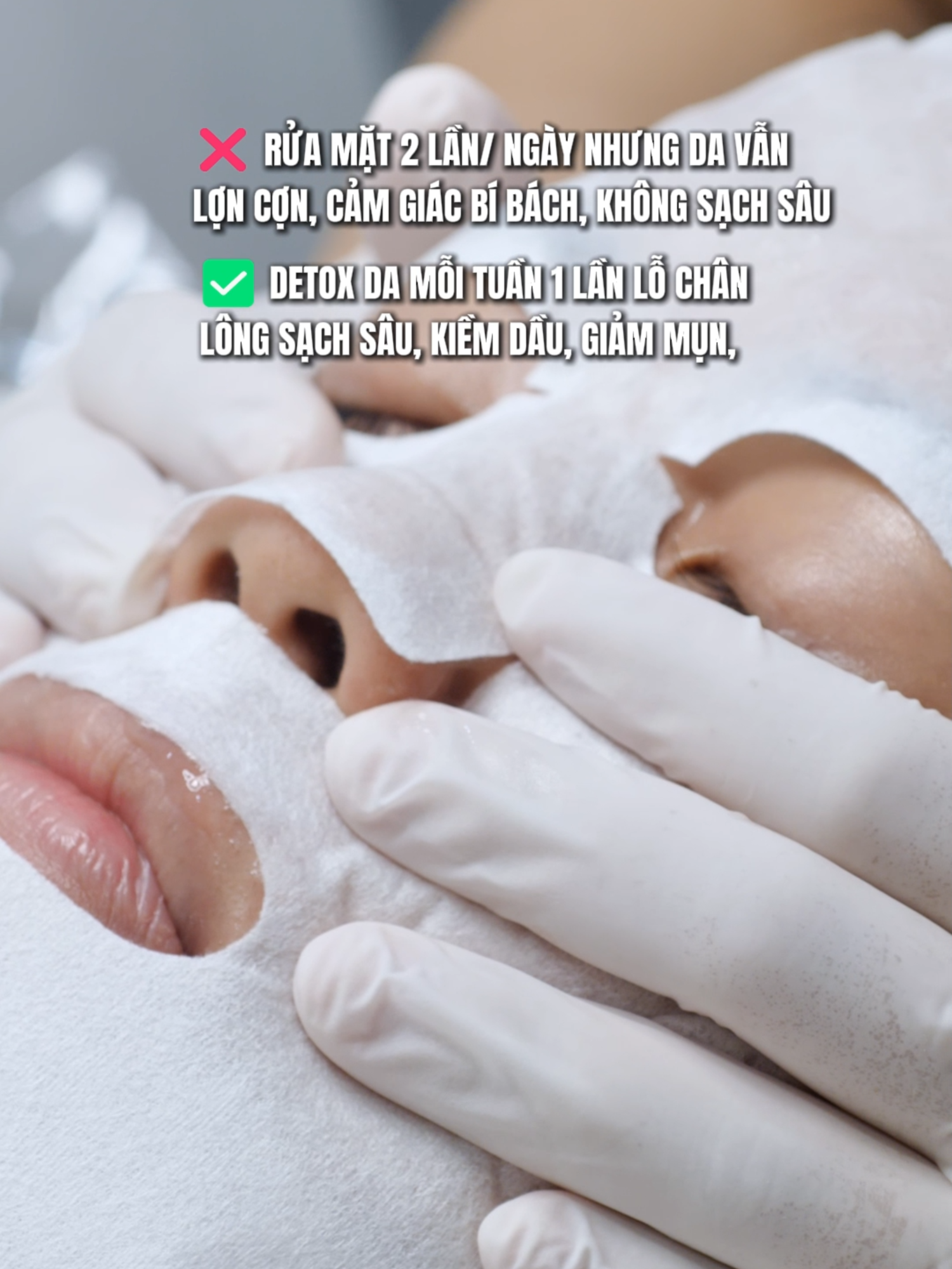 Giải pháp cho nàng nào rửa mặt 2 ngày 1 lần mà da vẫn lợn cợn, cảm giác không sạch sâu, bí bách!! #detoxda #detoxco2 #mialalanhatrang #spanhatrang #xh