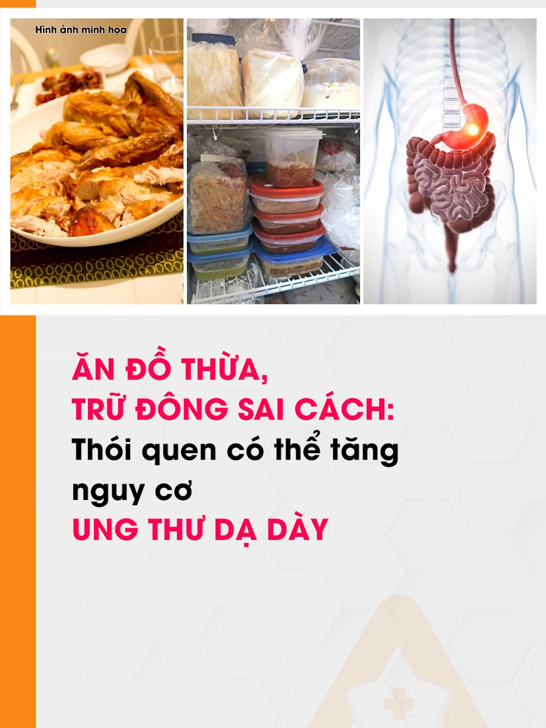 Ăn đồ thừa, trữ đông sai cách: Thói quen có thể tăng nguy cơ ung thư dạ dày #AloBacsi #Songkhoe247 #songkhoemoingay #tiktoknews #alobacsi