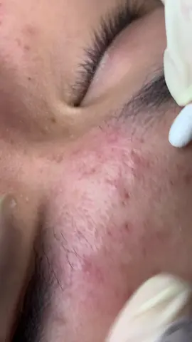 Mở#chamsocdaseo#chamsocda#chamsocdamun#chamsocdaseo#chamsocdanam#tanbinh#govap        