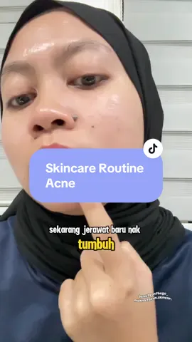 skincare routine untuk acne or hormonal acne. #skincareroutine #skincareacne #hormonalacne #breakoutskin 