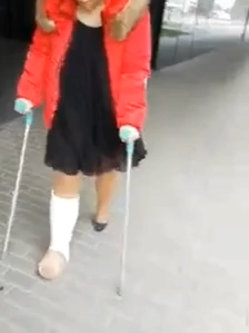 #gipsfuß #cast #crutches #krücken #platre #gips #gesso #nylons