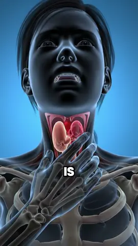 What is hypothyroidism? 9 early signs of hypothyroidism #health #healthy #healing #healthcare #healthtips #healthtip #nutrition #nutritiontips #hypothyroidism #hypothyroid 