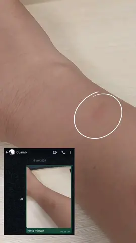 Bener bener gak espec kalo body wash bantu nyamarin bekas luka !!! @balikulturaofficial  #balikultura #balikulturabodywash 