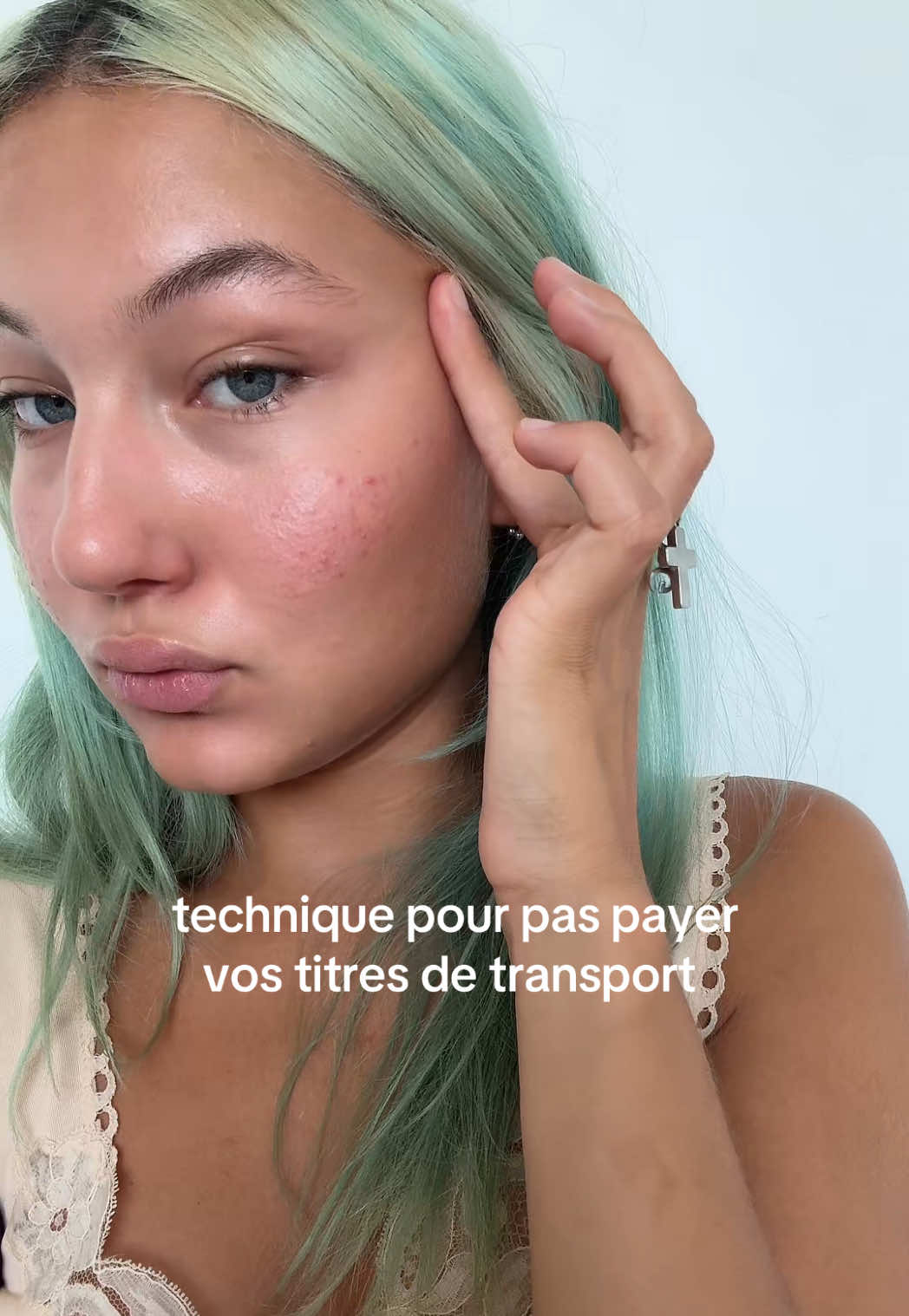 du coup faut juste payer les rdv chez la dermatologue de temps en temps mais ça va quoi #carteduvisage #facecard 