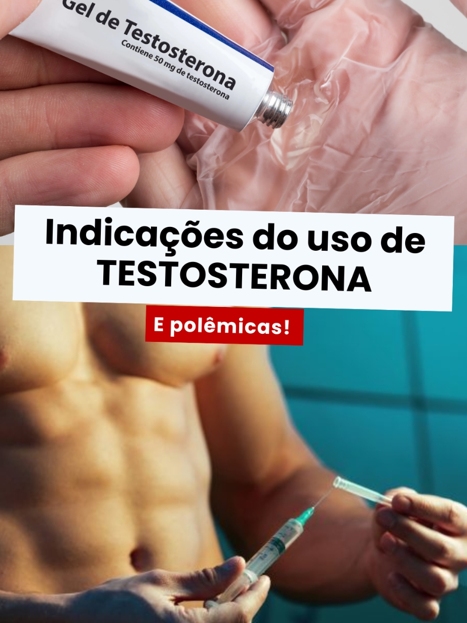 🚨 Testosterona: uso correto e o incorreto A testosterona tem indicações médicas restritas e bem definidas: ✅ Homens: hipogonadismo verdadeiro (sintomas + testosterona baixa em pelo menos 2 coletas matinais), conforme Endocrine Society Clinical Practice Guideline 2018. ✅ Mulheres: transtorno do desejo sexual hipoativo pós-menopausa, após corrigir outras causas, segundo o Global Consensus Position Statement on Testosterone Therapy for Women (2019). ❌ Fora desses contextos, não há evidência sólida de benefício — e os riscos são significativos. 📊 Meta-análise de 27 ensaios clínicos (n≈3.000) publicada por Xu et al., BMC Medicine, 2013, mostrou que o uso de testosterona esteve associado a odds ratio de 1,54 para eventos cardiovasculares graves. 📉 Estudos observacionais (Pope et al., Am J Cardiol, 2014; Rasmussen et al., Eur Heart J, 2021) demonstram maior mortalidade e maior incidência de hipertensão, aterosclerose e arritmias em usuários crônicos de anabolizantes. ⚠️ Principais riscos do uso indiscriminado: Policitemia (↑ hematócrito) → risco de trombose Alterações no perfil lipídico (↓ HDL, ↑ LDL) Infarto, AVC, morte súbita Mulheres: acne, hirsutismo, voz grossa, clitoromegalia Homens: atrofia testicular, infertilidade, ginecomastia 💡 Reposição hormonal não é estética. É um tratamento médico sério, com protocolo, monitoramento e indicação precisa. 📚 Referências: Bhasin S, et al. Testosterone Therapy in Men with Hypogonadism: An Endocrine Society Clinical Practice Guideline. J Clin Endocrinol Metab. 2018. Davis SR, et al. Global Consensus Position Statement on the Use of Testosterone Therapy for Women. J Clin Endocrinol Metab. 2019. Xu L, et al. Testosterone therapy and cardiovascular events among men: a systematic review and meta-analysis. BMC Med. 2013. Rasmussen JJ, et al. Increased mortality among users of anabolic androgenic steroids: a register-based cohort study. Eur Heart J. 2021. #cardiologia #endocrinologia #hormonios #anabolizantes #testosterona #faculdadedemedicina #medico #medicina #internato #medicos 