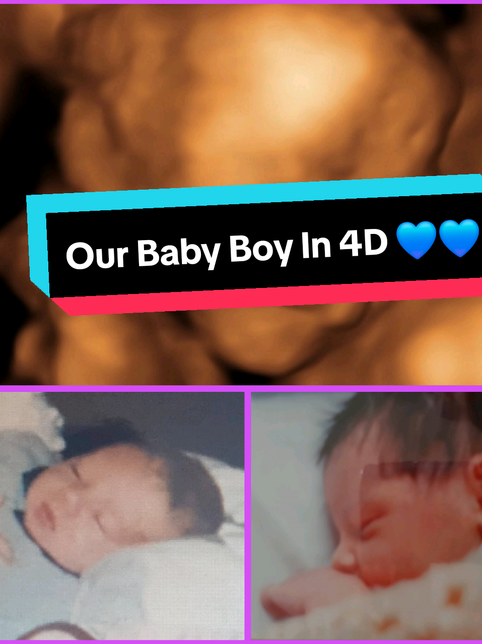 We had our 4D scan today, and baby boy is healthy, moving, and in position ready to meet us. 💙 Not long now baby boy, only 12 weeks to go 💙💙 @Peter  #27weekspregnant #28weekspregnant #babyboy #mounjarobaby #MJbaby #mounjarobabyboy #mamatobe #notlongnow 