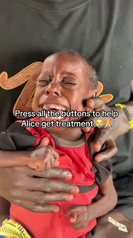 Even 10$ can help Alice get treatment 🙏😭 #disability #humanity #hungry #donate #homelesskids #support #feedinghomelesskids @Taylor Swift @Khabane lame @Selena Gomez @Kylie Jenner 