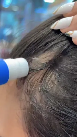 سيروم الشعر من سيبوري #تساقط_الشعر #انبات_الشعر #سيروم_الانبات_الشعر_سيبوري #fypシ #foryou #viral #explore 