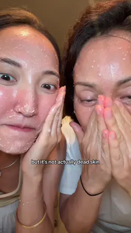 dead skin but not actually dead skin. BEST FEELING EVER! Using @Manyo Factory enzyme peel. #peelinggel #deadskin #exfoliation #clearskintips #kbeauty #skintexture #cleansingroutine 