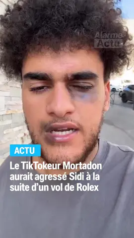 Le Tiktokeur Sidi aurait été agressé par Mortadon après qu’il aurait volé sa montre Rolex #teameco #mortadon #actu #marseille 