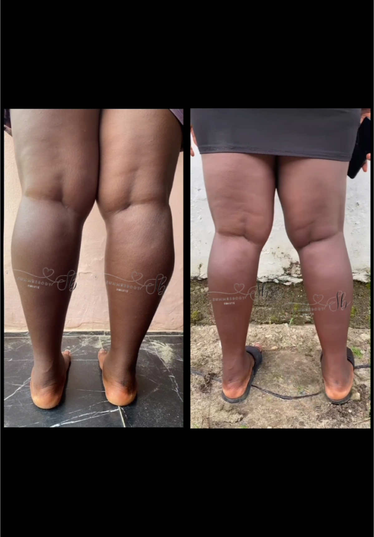 S'il vous plaît continuez à nous envoyer vos résultats, nous aimons les voir, client satisfait ❤️💃🏽💃🏽💃🏽💃🏽💃🏽 grandes jambes gros mollets femme gros mollets complexe gros mollets homme gros mollets femmes petit mollet gros mollets fille fait fondre la graisse Mollettremble lamolletdemyla Chaise veau Mollet Depasse Cuissardes en veau gras Affiner les veaux brûleurs de graisse mollets perdre des veaux #mollet #jambesfines #grosmollets  #bruleurdegraisse  #bigcalves #jambes 