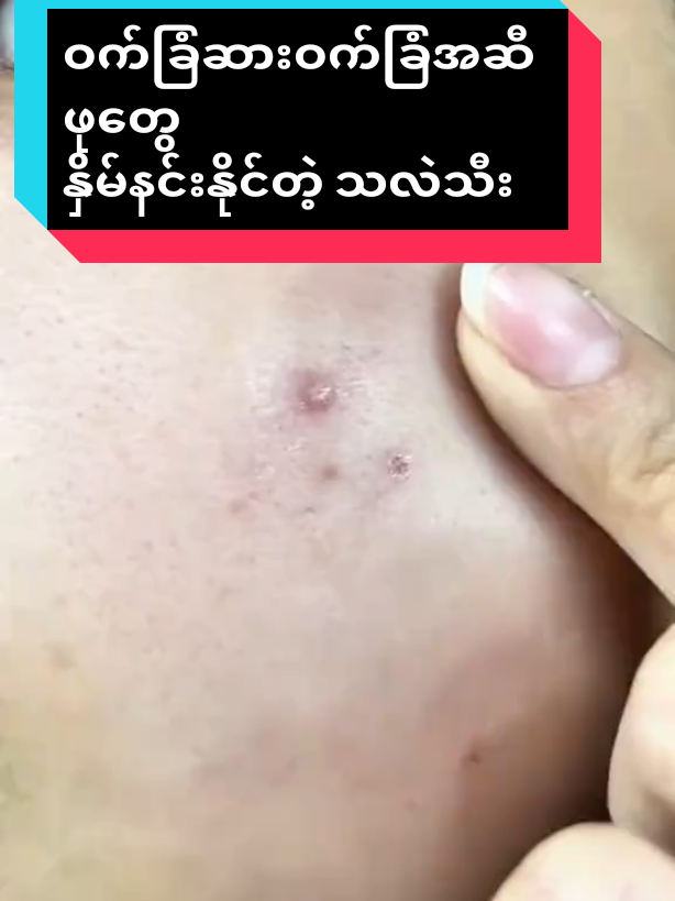 #viber09458460617 #ချစ်တဲ့မဖြိုး #Pakokku #ီလက်လီလက်ကားရပါတယ်ရှင့် #tiktokmyanmar🇲🇲 #thanktiktok #####tiktok2025 #@မလဲ့💙 @ヅBenjiro꧂ @Pan Ei Phyu 