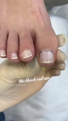 Giải pháp cho móng gọn đẹp – Lấy khoé dễ dàng, nhanh chóng 🎯 #dungcunail #laykhoemong #nailcare #naildep #tiktoknail #nailtok