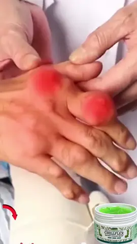 #jointpain #jointhealth #joint #jointpainrelief 