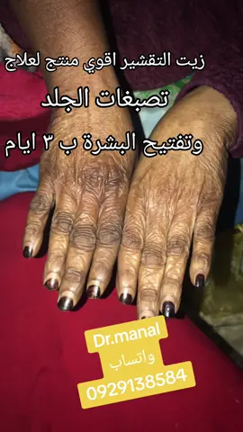 مقشر زيت التقشير ارهب واقوي منتج لعلاج كل مشاكل الجلد #اكسبلور #السودان_مشاهير_تيك_توك #تفتيح_البشرة #الرياض_جده_مكه_الدمام_المدينه #السعودية🇸🇦 #سودانيز_تيك_توك #مشاهير_السودان_تيك_توك #الشعب_الصيني_ماله_حل #تشاد🇹🇩 #سودانيز_تيك_توك_مشاهير_السودان #سودانيات_في_مصر #اسوان_الاقصر_قنا_سوهاج_اسيوط_السودان 