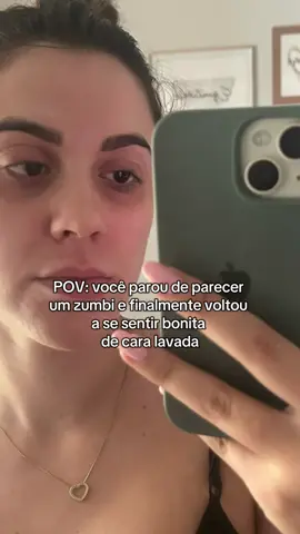 Sem olheiras e sem flacidez!  #olheiras #flacidez #skincare #rugasdeexpressao #linhasfinas 