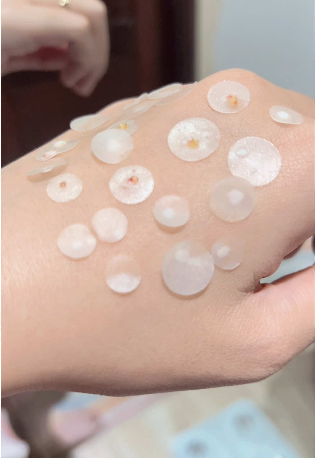 #miengdanmun #danmun #focallure #focallurebeauty #danmuntanghinh 