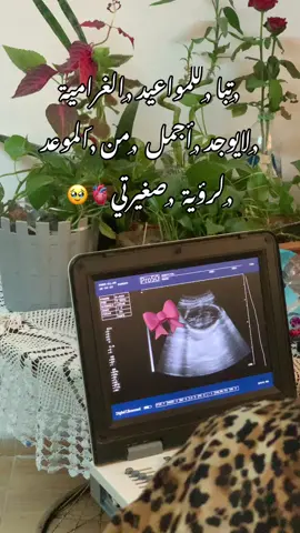اريد ان أنظر لها حتى عيني تكتفي فهي صبري وملاكآ بصورة ذريتي لم يكن الطريق سهلآ ياصغيرتي ولكن لقاؤك يستحق الانتظار ويستحق كل شيء🎀🤱🏻