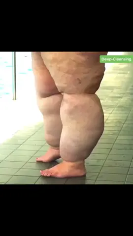 Tanpa obat, tanpa alat, tanpa ribet!