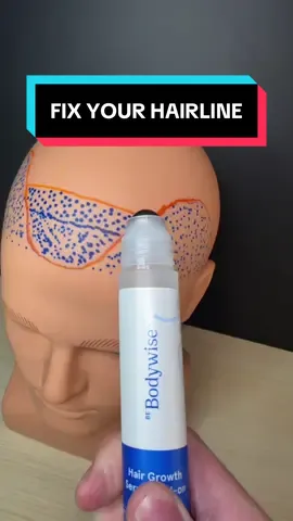How to fix your hairline without the harsh chemicals… #bebodywise #hairgrowthserum 