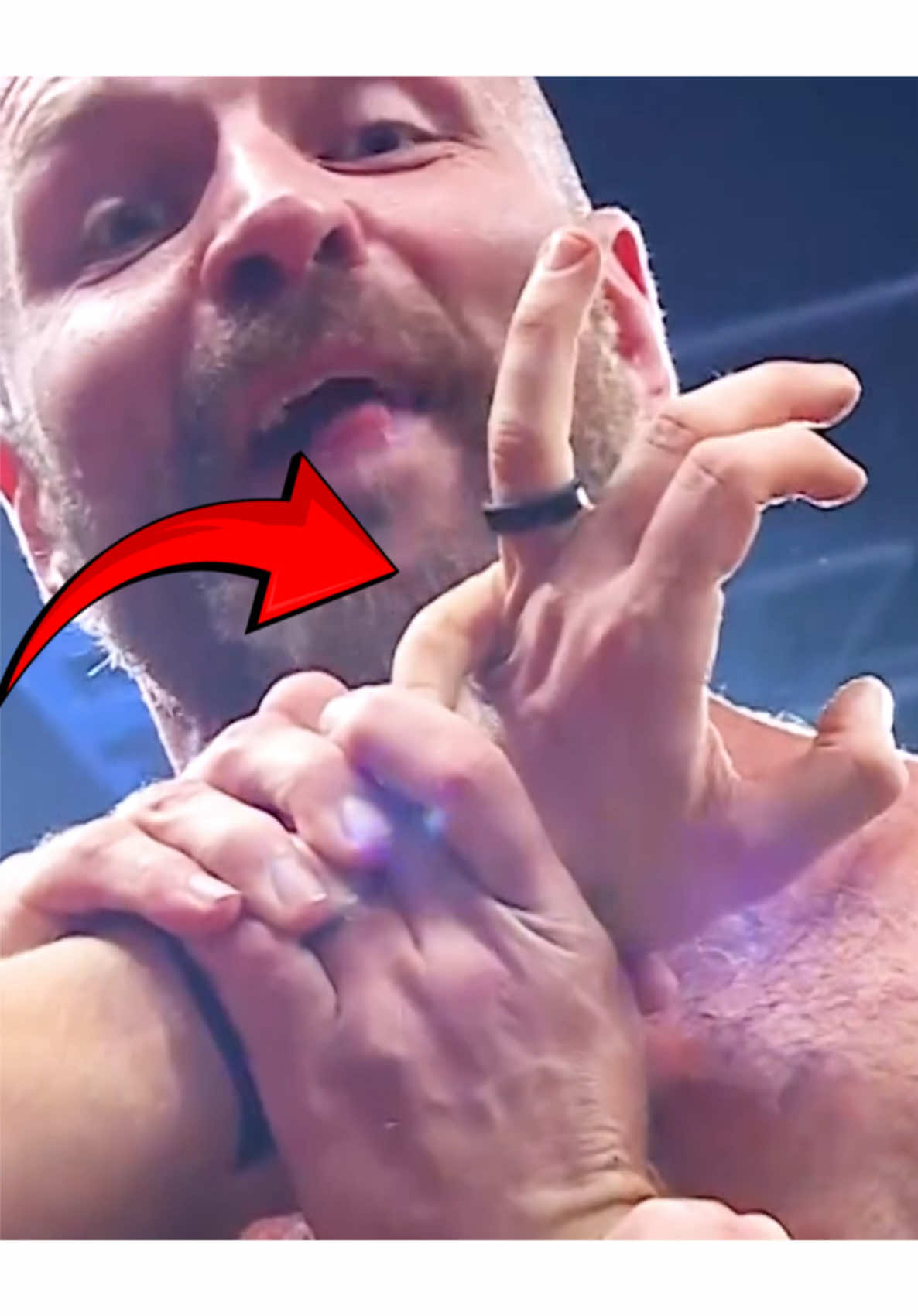 Fingers ARE NOT supposed to bend that way! 😦🫣