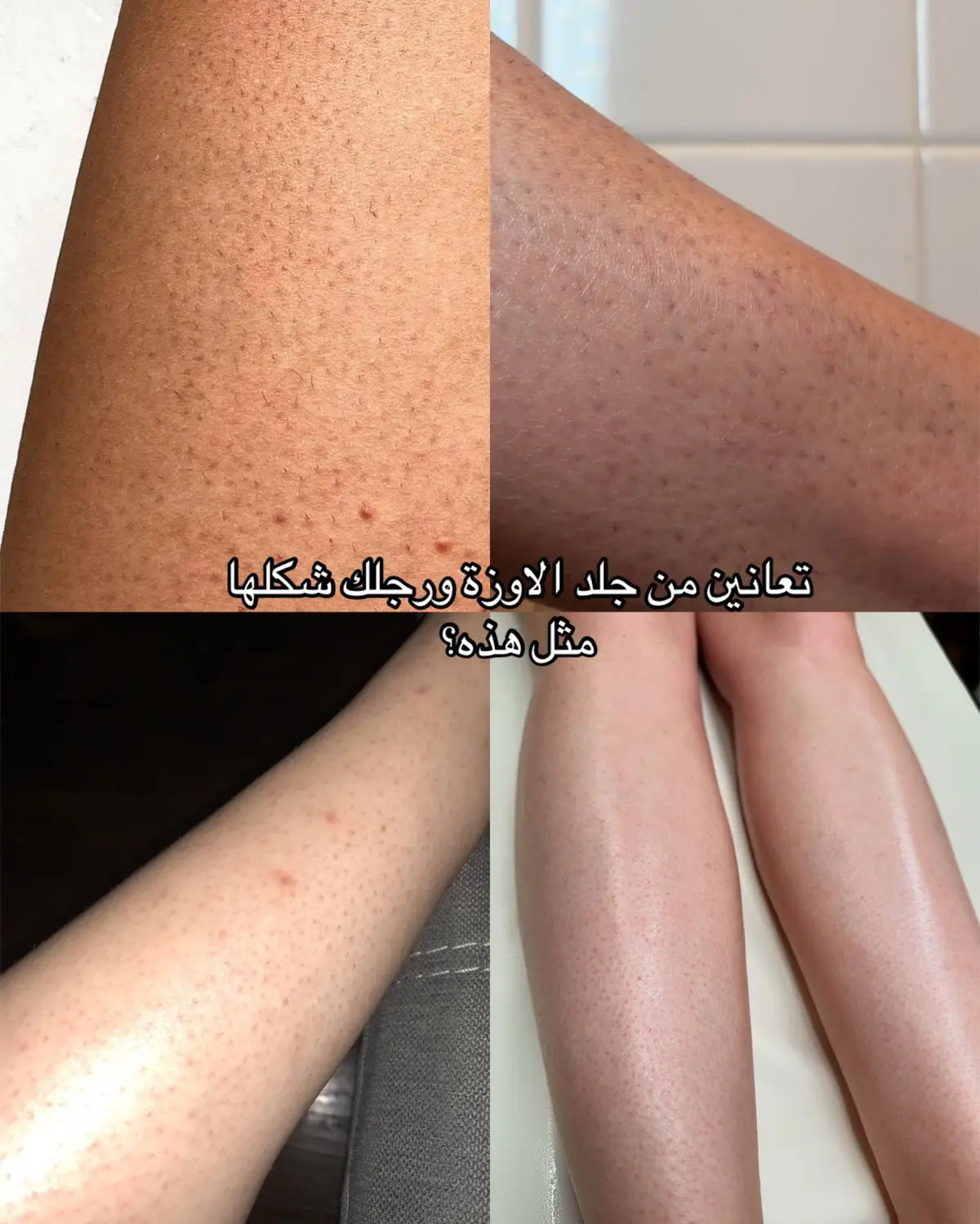 ❤️❤️ #beauty_by_monangel #fypシ゚ #foryou #viral #fyp #fyp #trend #glowupchallenge #fyypppppppppp #GlowUp #جلد_الاوزة #glowyskin #care #bodycare 