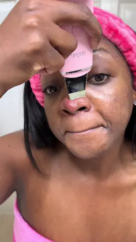 I didn’t expect this much gunk to come out of my skin 🤯 This scrubber is my new skincare obsession. Got it on TikTok Shop 🛍️👇 #TikTokMadeMeBuyIt #GugugSkinScrubber #SkincareRoutine #BlackheadRemoval #PoreCleaner