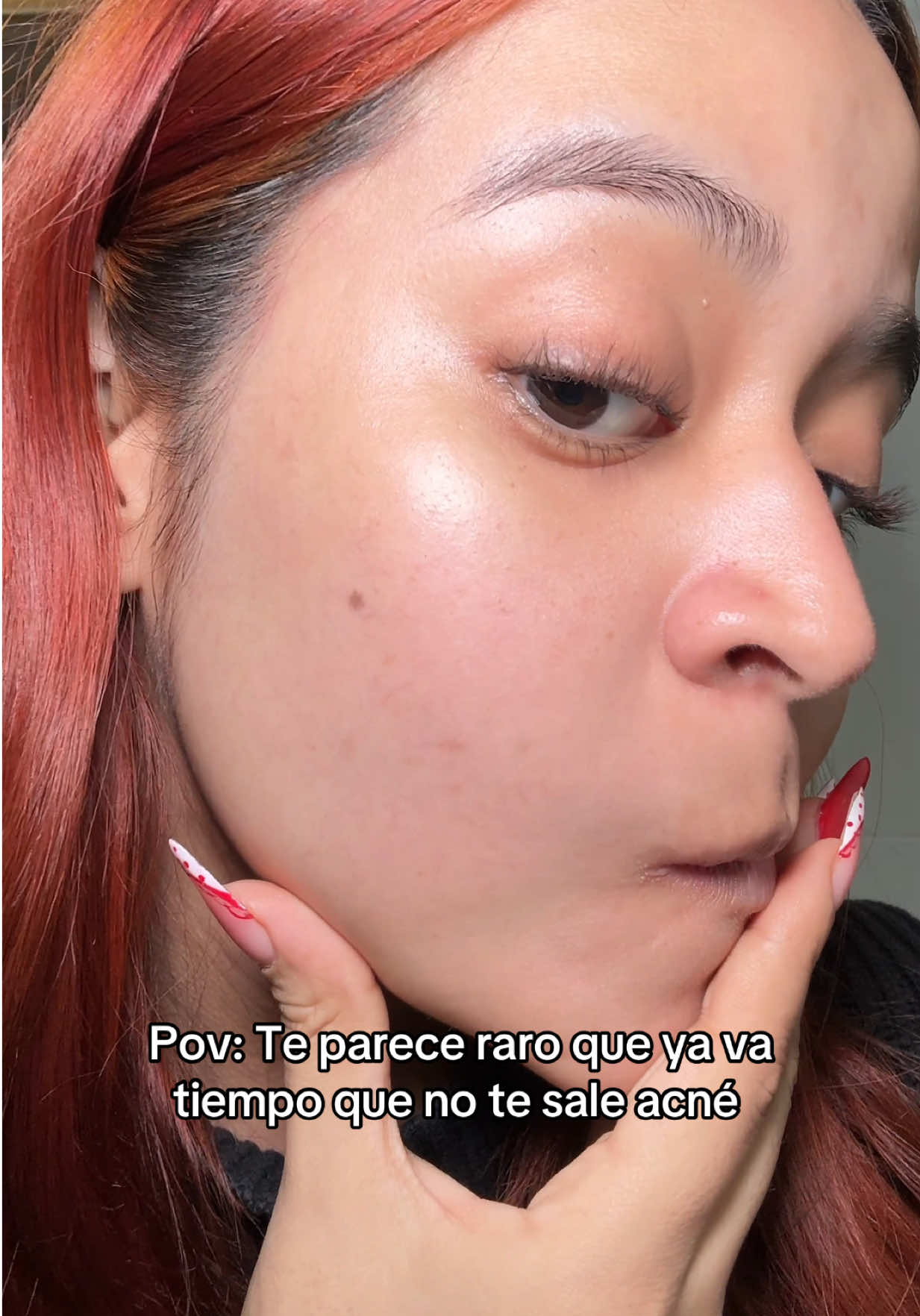 Cuando ya va tiempo que no te sale acné o comedones #acne #acné #comedones #pimples #pimpleremover #skintok #kbeauty #girls #fypシ゚ #fypppppppppppppp #xybca 