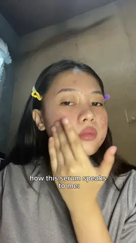 #dermorepubliq #dermorepubliqserum #dermorepublicniacinamide #acnetreatment #acnefighter 