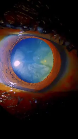 😍🥰 Real Universe in our eyes 🤯👀🪐 #retina #eye #eyedoc #ophthalmology #oftalmoloq 