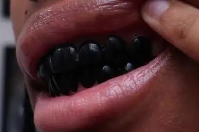 grillz? #grillz #edit #fyp 