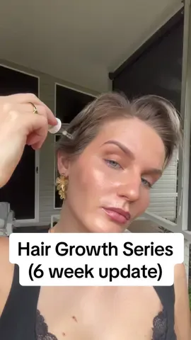 No minoxidil for 6 weeks!! Here’s my update 🫶🏼 Added a new addition to my hair growth routine with @The Ordinary hair serum- let me know if you’ve tried it too. #hairgrowthtips #hairserum #hairgrowthproducts #minoxidil #alopecia 