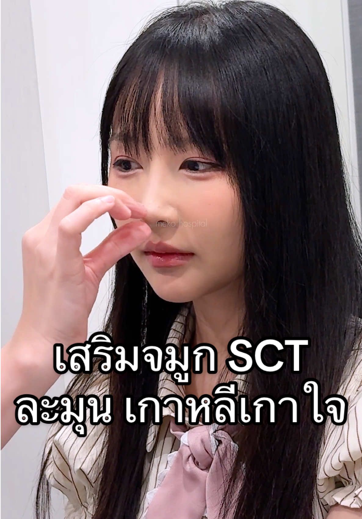 จมูก Sct เน้นธรรมชาติ สวยขึ้นจนไม่รู้ว่าไปทำอะไรมา #เสริมจมูก ที่รับกับรูปหน้าเฉพาะบุคคล #หมอมิวmeko #หมอมิวmekohospital #mekohospital #meko 
