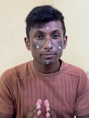 NO dark spots with ONE cream