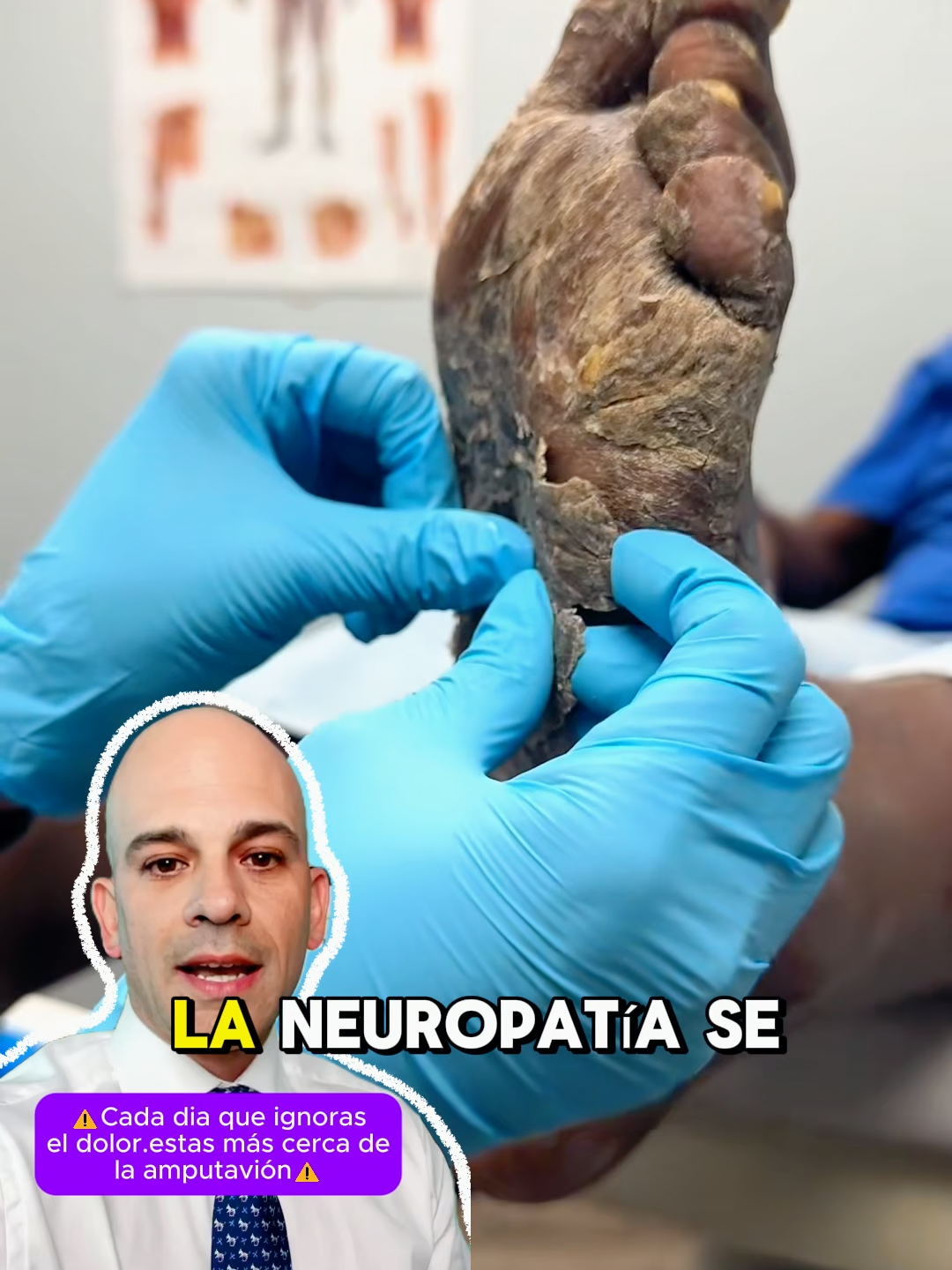 ¿REPARAR NERVIOS + ELIMINAR NEUROPATÍA + MEMORIA DE ADOLESCENTE? 🧠 ¡SÍ! Neurólogos CONFIRMAN: SMARTO-ONE LO HACE (Solo 2 cápsulas/noche) 💊 OFERTA RELÁMPAGO ⚡#legpain #neuropatia #Brain #Neurological #Sleep #tiktokshop #alzheimer #healthyliving #braincleansing