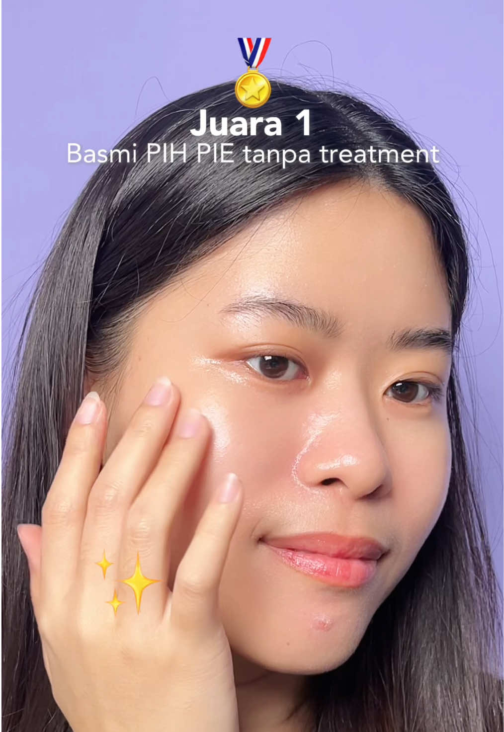 Basmi hiperpigmentasi anti ribet, tanpa treatment?🤔 #Somethinc #PakaiSomethinc #SomethincSKINBOOSTER 