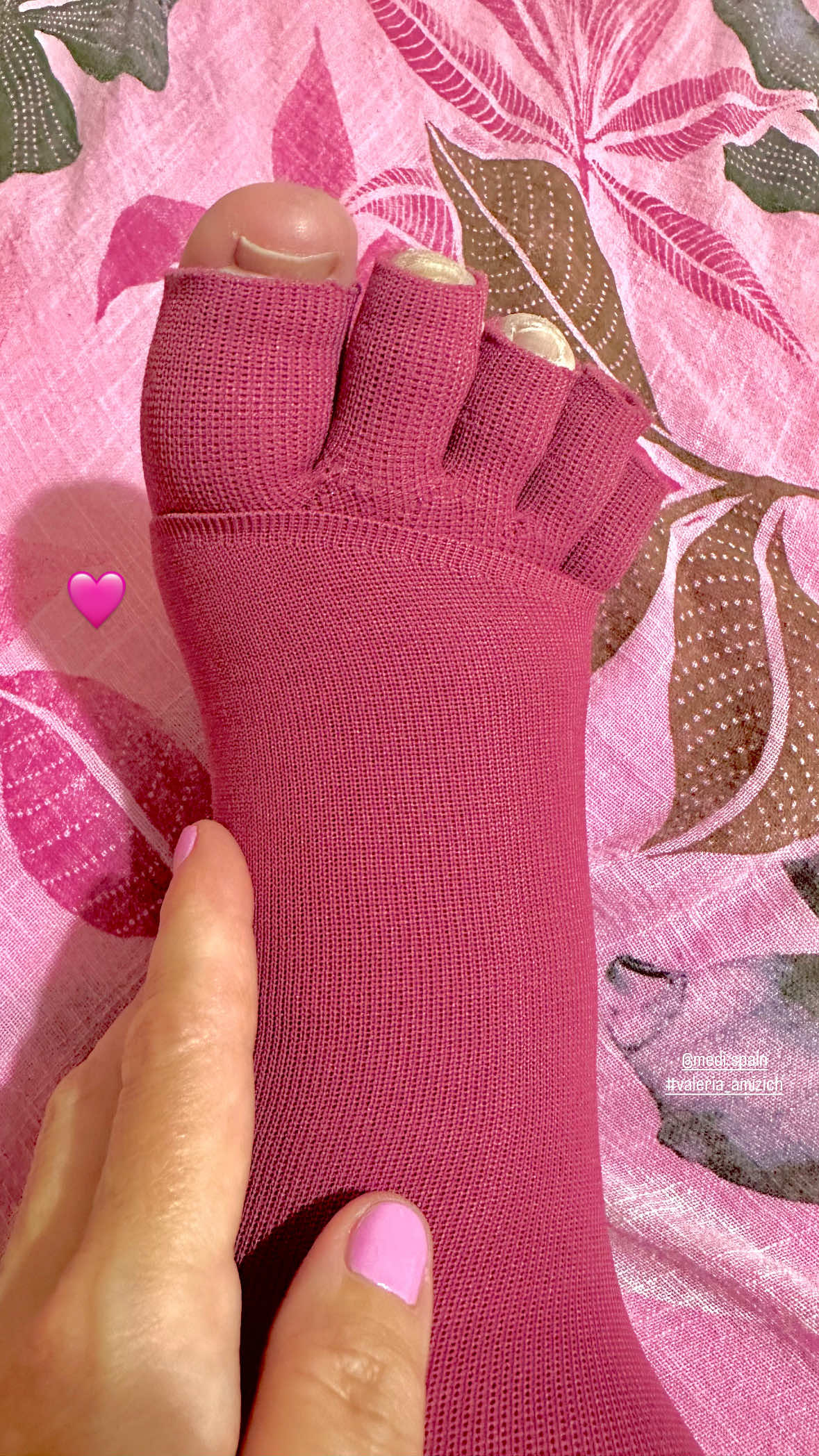 Ajustando guante de compresión médica tejido plano💕 #compression #linfedema #enfermedadesraras #valeria_amizich #linfedemaprimario 