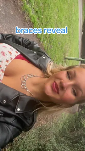 #braces #bracesreveal #navy #bluebraces #dentist  