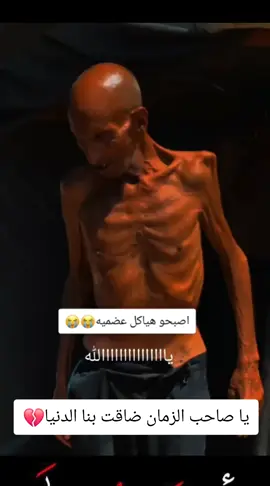#غزة #اكسبلور #معاناه أهل غزة 