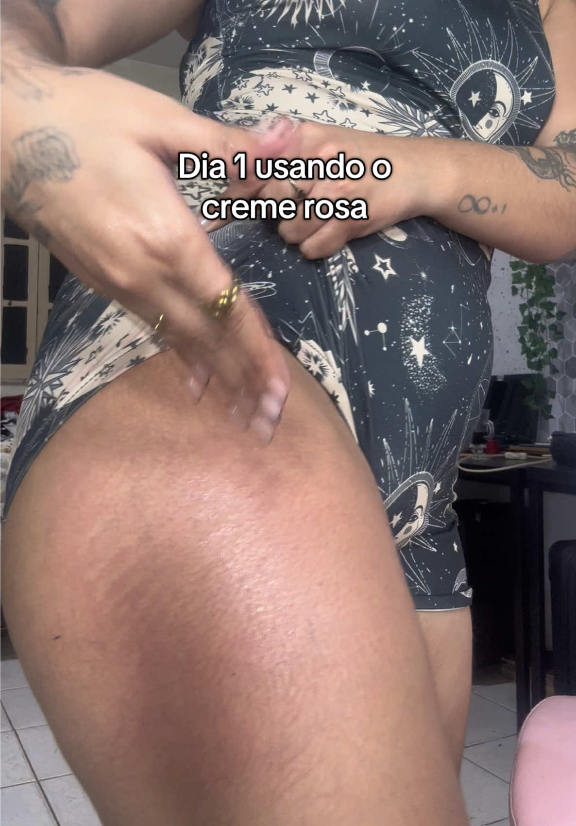 Ah se eu tivesse acreditado antes 😮‍💨 #cremeestrias #cremeparaestrias #estrias #estriasbrancas #cremeadeus 