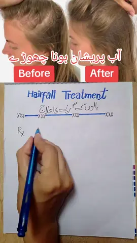 Hair fall treatment medical track medicalinformatiom healthcare health tips #shortvideo#viralvideos #treandingvideo #please unfreezmyacxount#fyp foryoupage