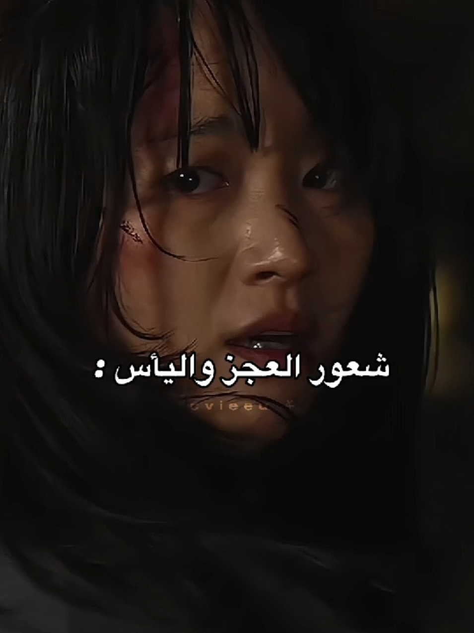 قهرتنيي اللقطة ☹️ #foryoupage #explore #foryou #4u #thedefects 