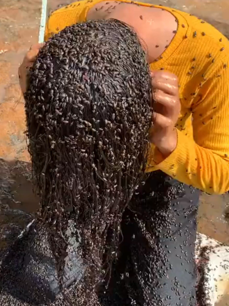 This 14 year old girl had many insects in her hair, and what doctors found in her head, shocked the whole world. #hair #bugs #fyp #LearnOnTikTok #tiktokusa 