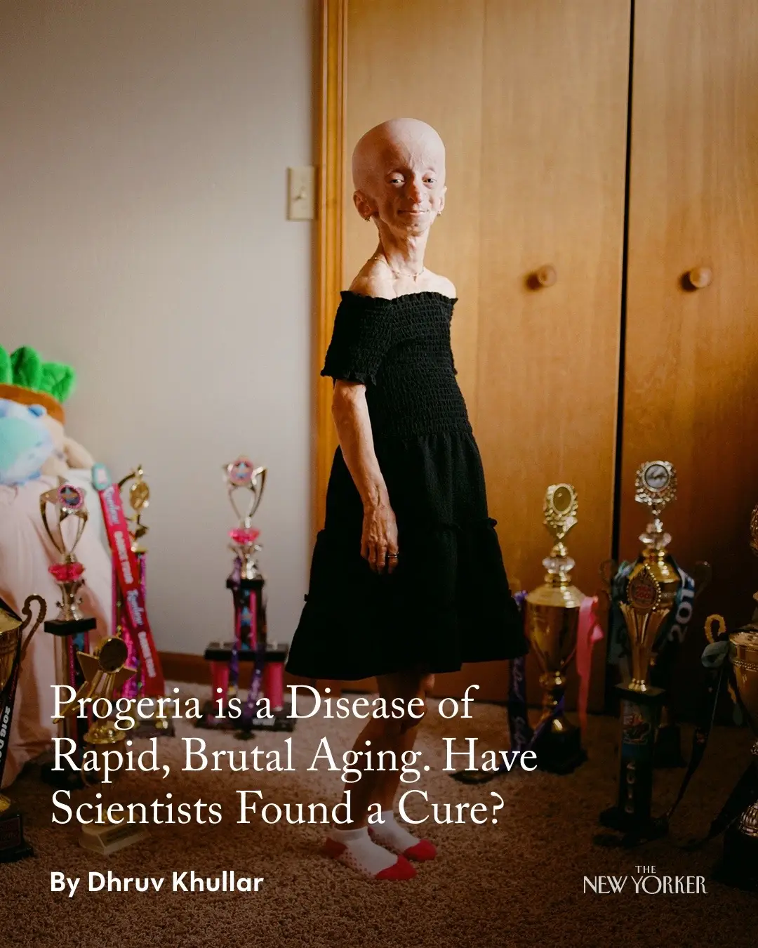 Progeria is a disease of rapid, brutal aging that is thought to afflict fewer than one in every four million babies. By the time children with progeria enter their teen-age years, their bodies have effectively aged eight or nine decades. They have a distinctive appearance: small, wizened, and bald, with wrinkled skin, rigid arteries, stiff joints, and weak bones. Many die of heart attacks before their 15th birthday—but for the first time, it seems plausible that the disease could be cured. At the link in our bio, Dhruv Khullar reports on a gene-editing treatment and spends time with Kaylee Halko (@Kaylee Halko), a 22-year-old living with the condition. #Science #genetics #progeria